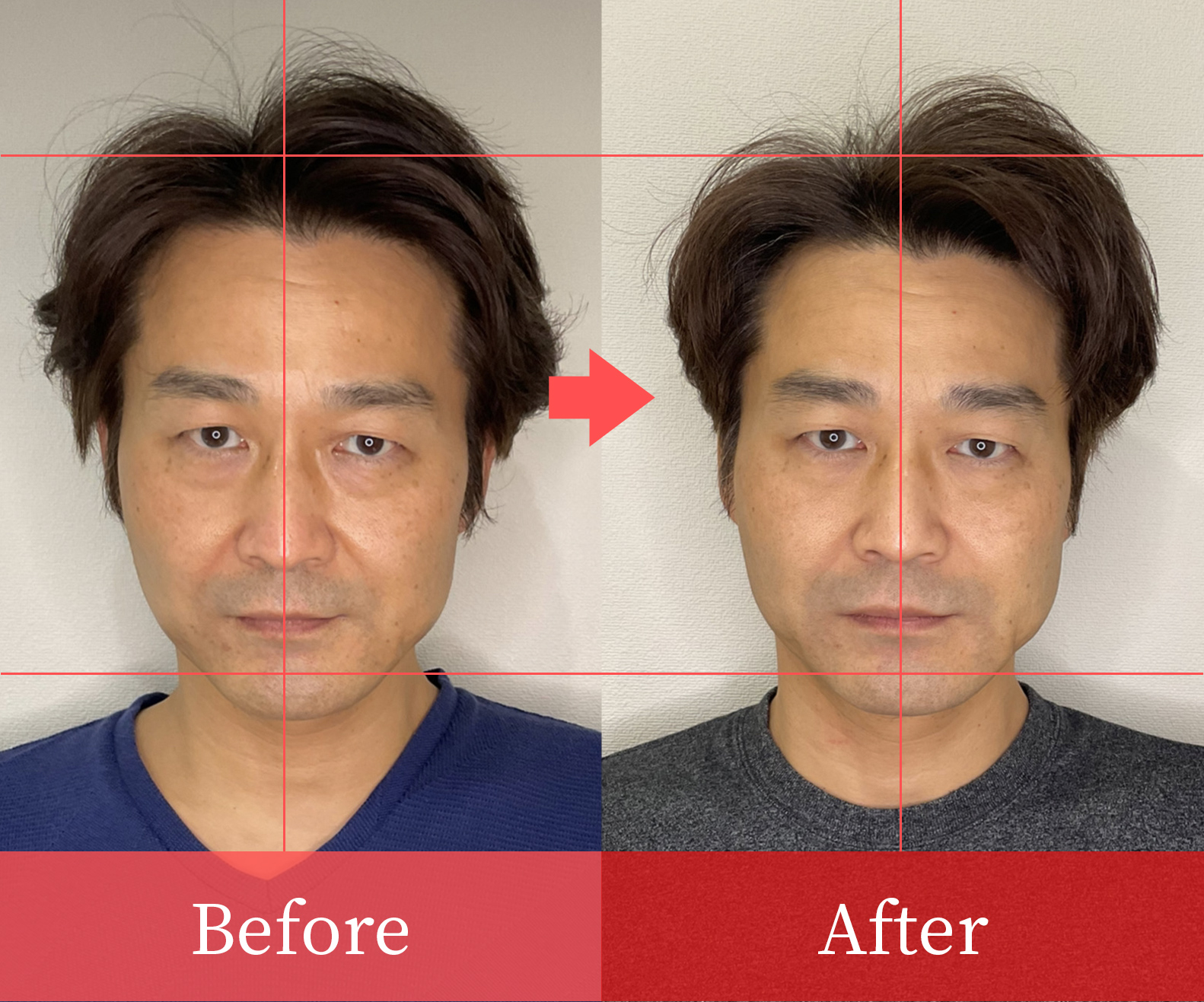 Before・Afterの写真